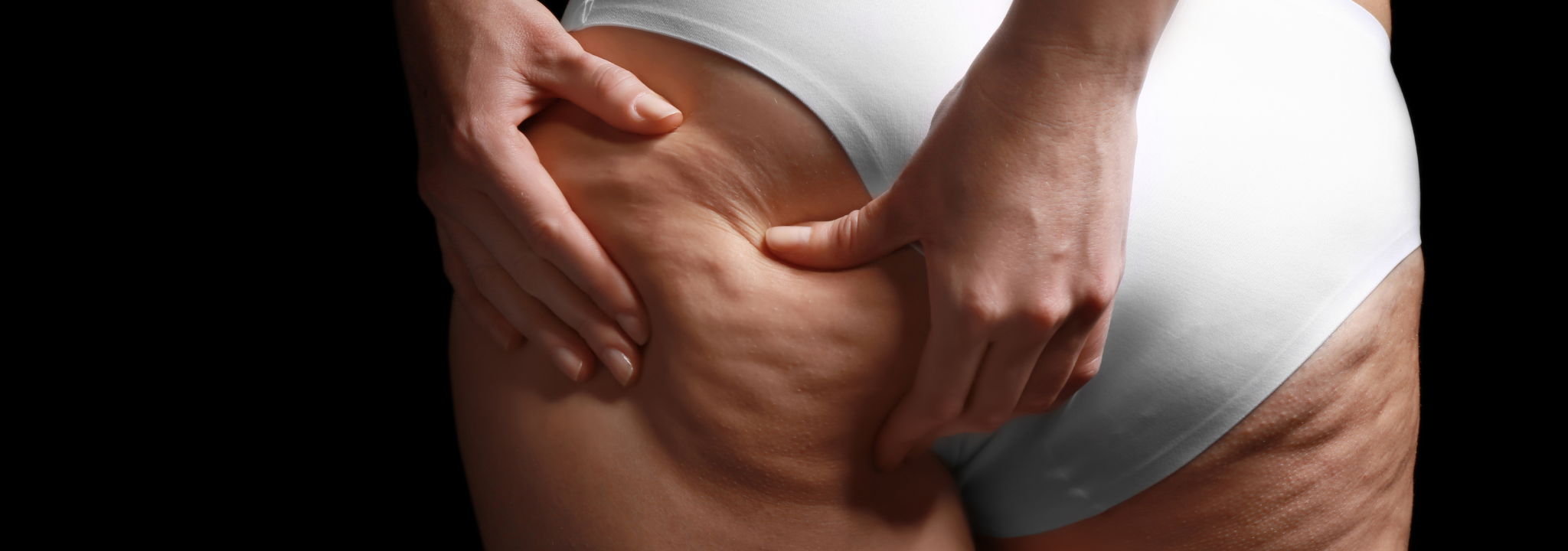 4 Ways to Ease Your Cellulite Woes